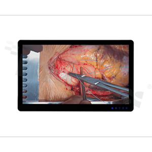 Monitor medyczny 55"; EN60601 ; 16:9; IP65 front; typ dotyku: PCAP; 1920x1080; jasność 600 nitów; kontrast 4000:1; kąt widzenia 178/178; 2xDVI; DP; VGA; CVBS; USB; RS232; temp. pracy: 0+40 st.C; zasilanie AC +zasilacz; VESA