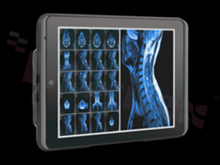 8" Intel Atom Z8350 Mobile Clinical Assistant