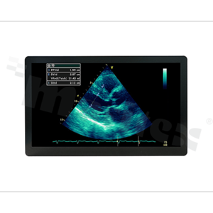 Monitor medyczny 24"; EN60601 ; 16:10; IP65 front;typ dotyku: PCAP; 1920x1200; jasność 270 nitów; kontrast 1000:1; kąt widzenia 178/178; 2xDVI; DP; VGA; CVBS; S-Video; USB; temp. pracy: 0+40 st.C; zasilanie 24V DC +zasilacz; VESA