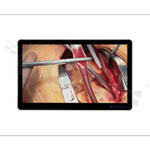 Medical monitor 55 "; EN60601; 16: 9; IP65 front; touch type: PCAP; 3840x2160; brightness 380 nits; contrast 4000: 1; viewing angle 178/178; 4xDVI; 2xDP; VGA; USB; RS232; working temp .: 0+40 degrees C; AC + power supply; VESA